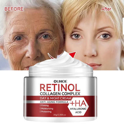 Retinol Wrinkle Removing Cream Anti Aging Firming -